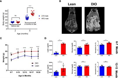 Aging augments obesity-induced thymic involution and peripheral T cell exhaustion altering the “obesity paradox”